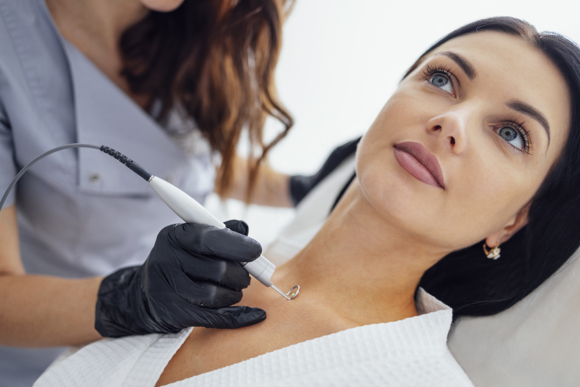 Beautiful caucasian young woman is doing a mole removal procedure in a modern beautyl clinic